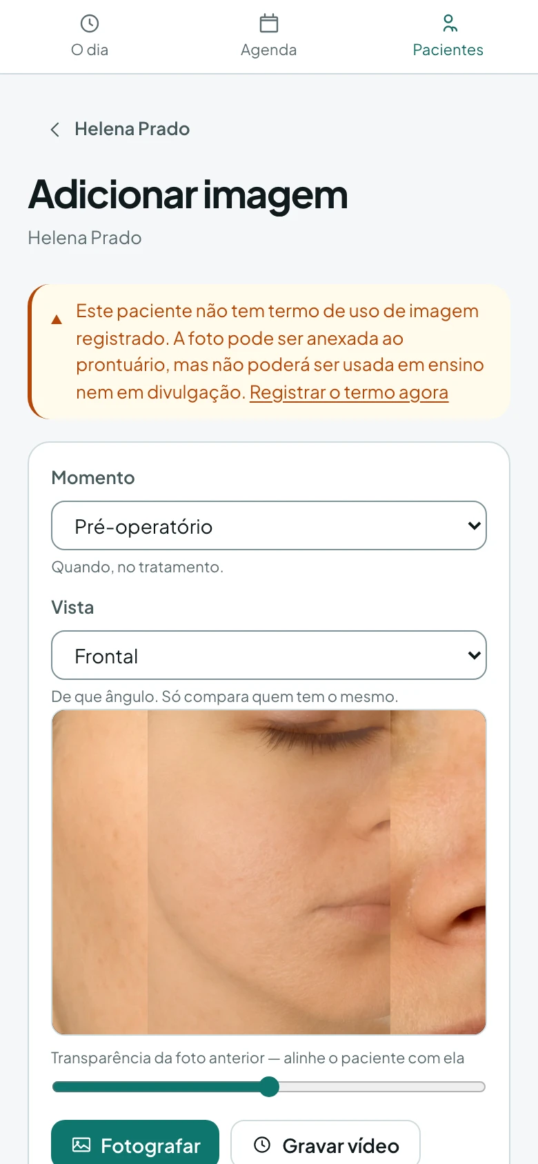 Câmera com a foto anterior sobreposta em transparência, e o controle que regula essa transparência, para repetir o enquadramento.
